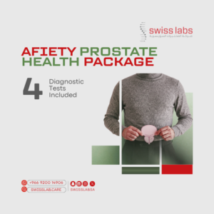 Prostate health test with PSA and urinalysis in Jeddah