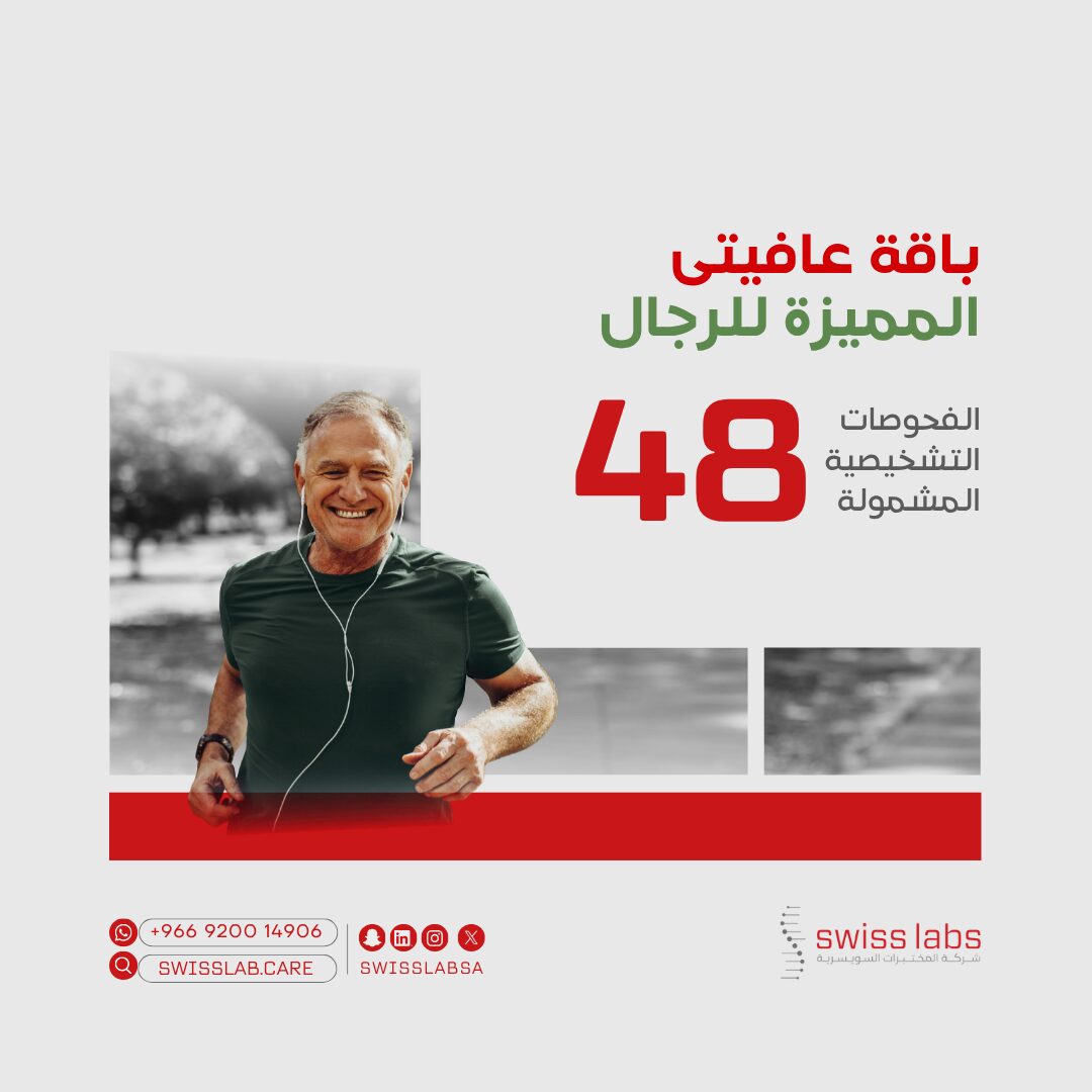 فحص شامل للرجال في مختبر سويس لاب بجدة