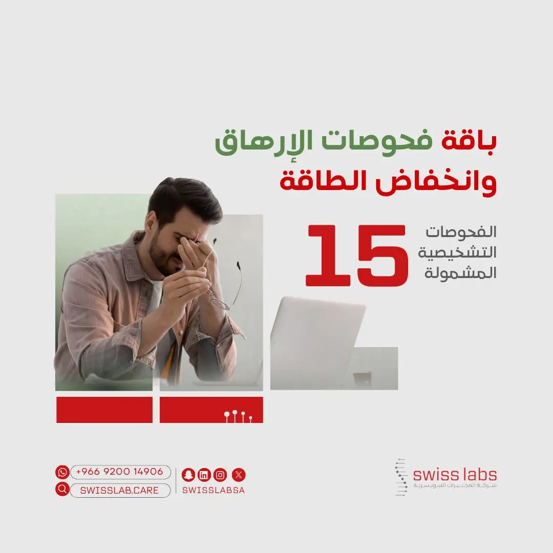 تحاليل التعب والإرهاق في مختبر سويس لاب بجدة