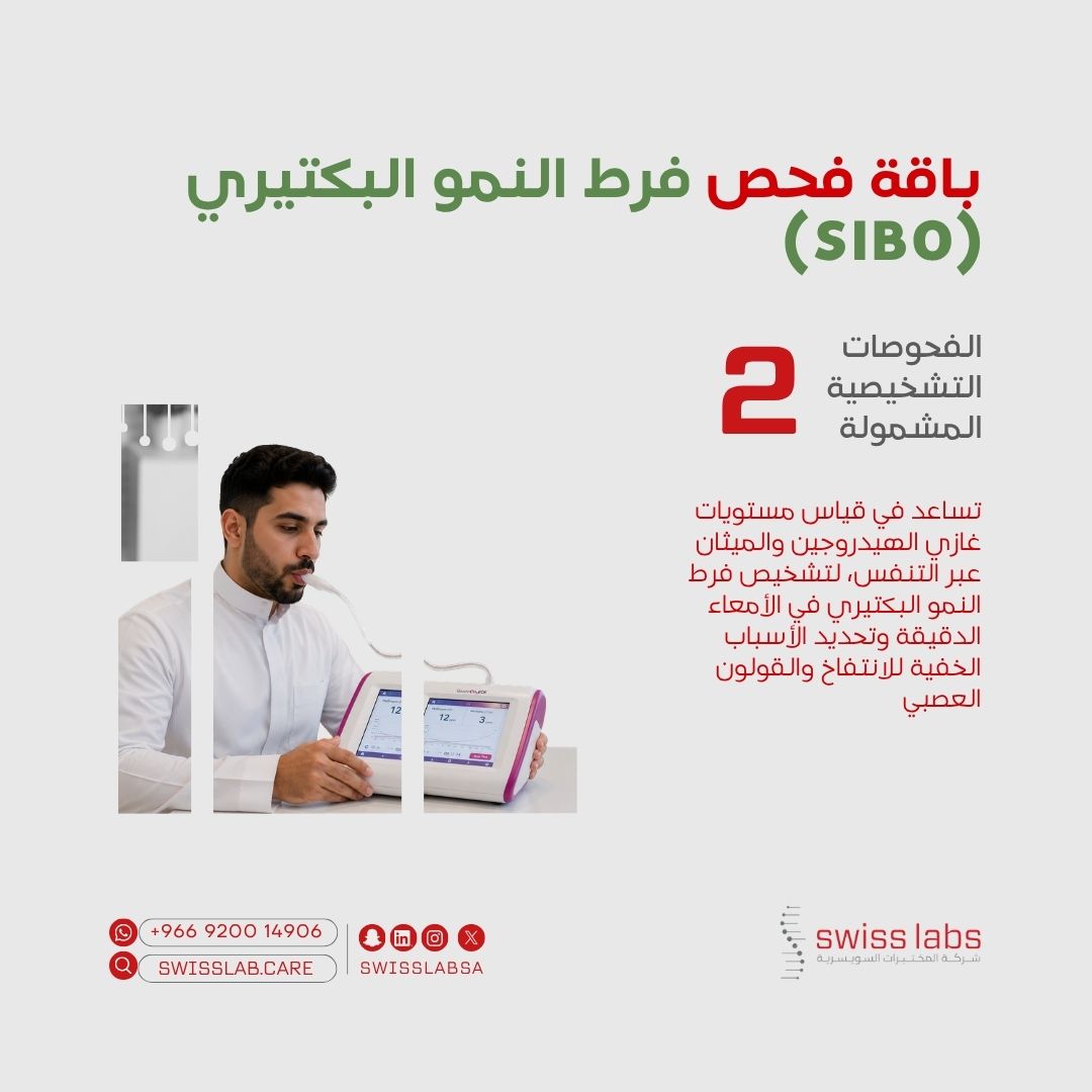 تحليل SIBO لاختبار غازي الهيدروجين والميثان في مختبر سويس لاب بجدة